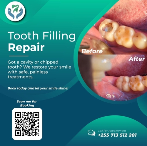 TOOTH REPAIR