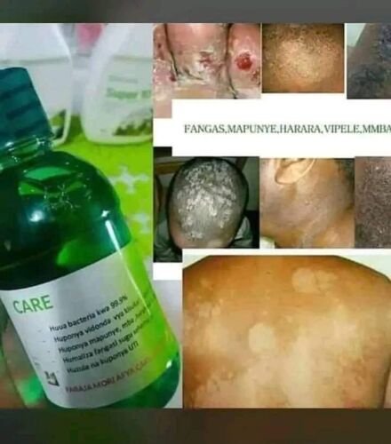 Pata care Kwa faida zaidi