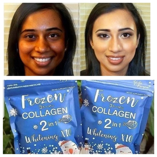 frozen collagen 2in1 whitening 10x