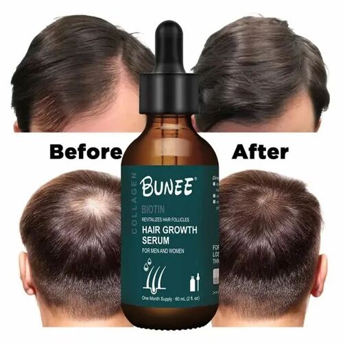 Bunee Hair Growth Serum 