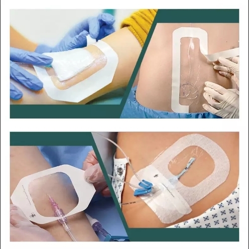 SELF ADHESIVE SURGICAL WOUNDS DRESSING 